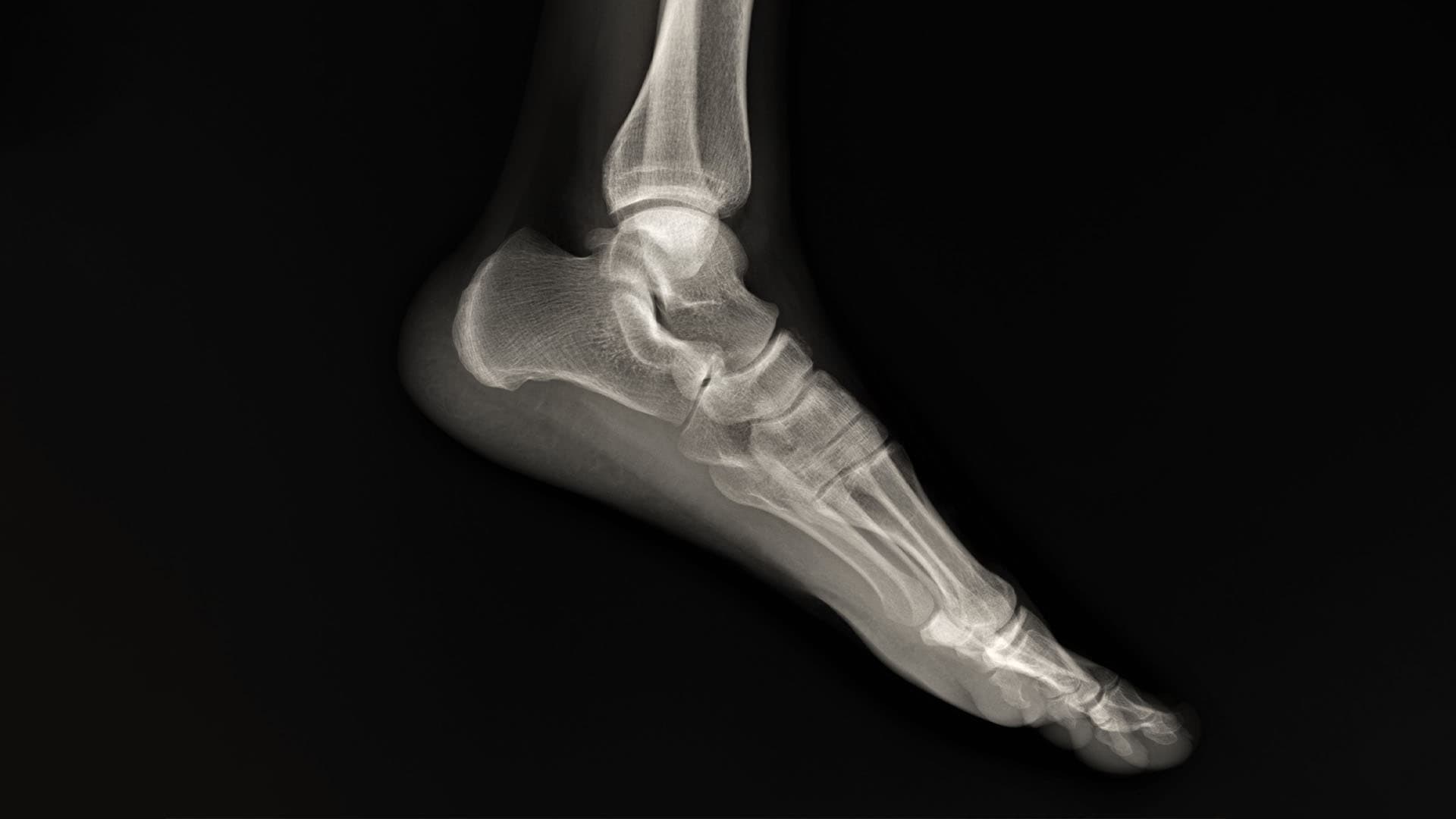 chapter-2_2_midsole-technologies-to-the-test